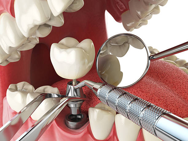 Best Emergency Cosmetic Dentistry in Toluca, IL